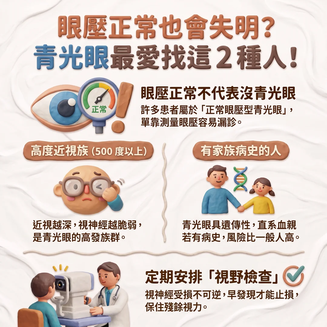 青光眼高風險族群須知（圖／AI生成製圖）