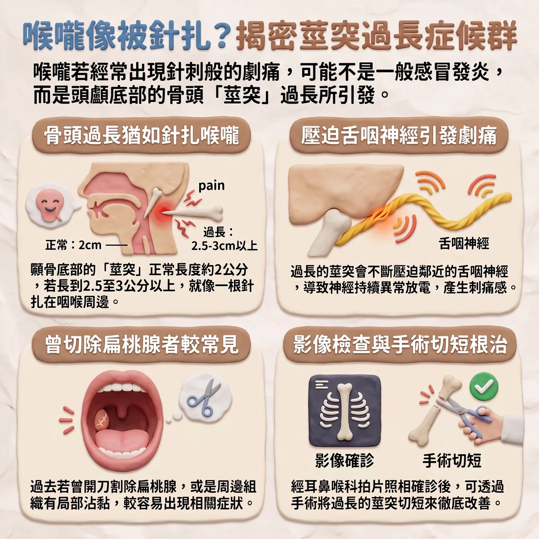 揭密莖突過長症候群(圖/AI生成製圖)